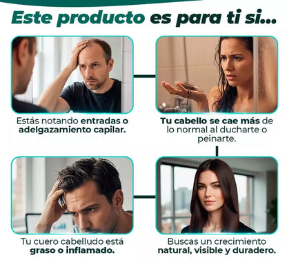 DHT Blocker - La Solución Natural Que Detiene la Caída Capilar